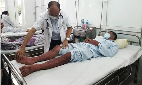 Sốt xuất huyết Dengue: Đừng để nguy kịch vì chủ quan