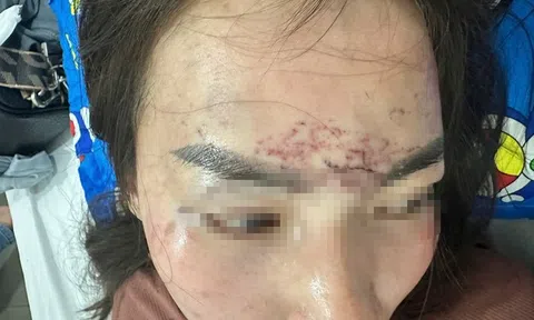 Diễn biến mới vụ người phụ nữ bị cắt tóc, xăm mặt ở Cà Mau