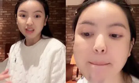 Chu Thanh Huyền kể lại trải nghiệm kinh hoàng khi đi xử lý hậu quả phẫu thuật thẩm mỹ